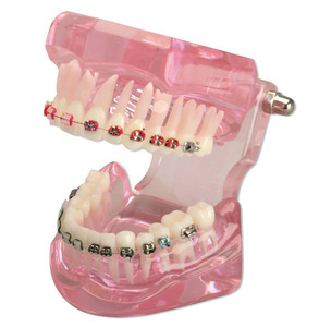 Ortho-Breketi