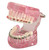 Ortho-Breketi